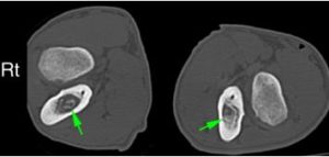 CT scan, brentknoll, vets